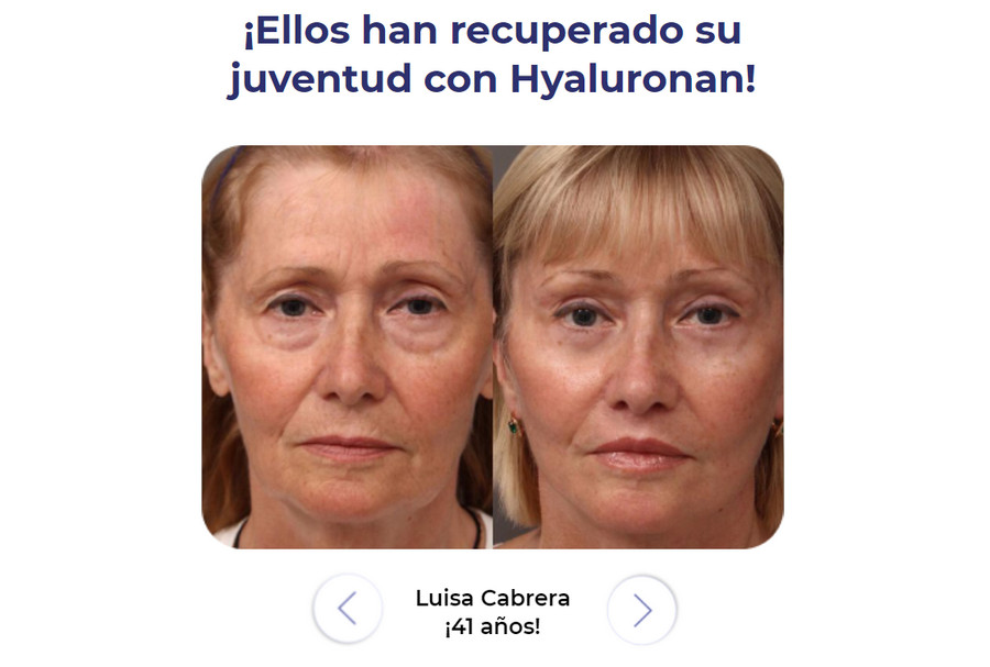Hyaluronan es bueno